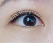 双眼皮