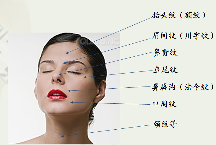 美国的微整形趋势——透明质酸(玻尿酸)