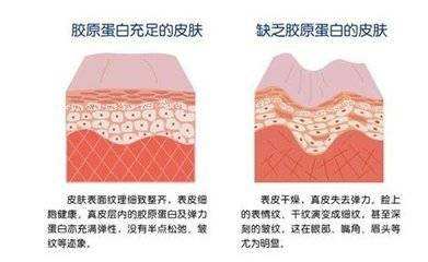 西安画美医疗美容医院-除了抗衰,还能填充?胶原蛋白你了解多少