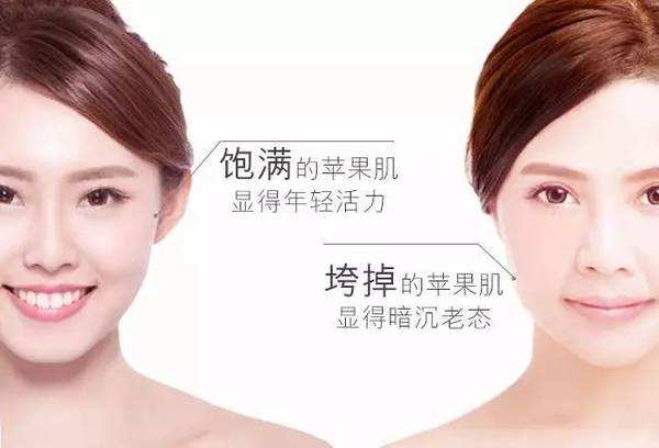 西安画美医疗美容医院-玻尿酸丰苹果肌什么价位合适