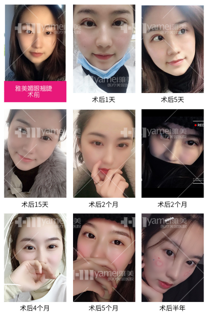 暮色综美瞳怎么样,暮色综美瞳怎么样好看吗